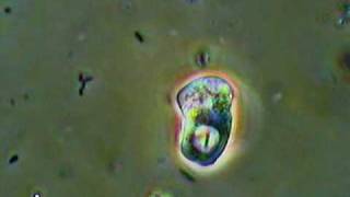 Active Amoeba Feeding [upl. by Rooker]