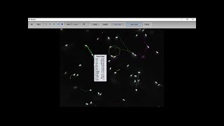 MMC Sperm Siberian sturgeon sperm motility analysis [upl. by Eilyab]