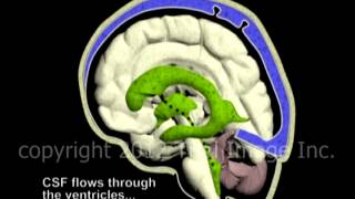 Hydrocephalus and Cerebrospinal Fluid CSF circulation by Dr Cal Shipley MD [upl. by Fagin506]