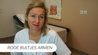 Rode ruwe bultjes bovenarmen Keratosis pilaris  Tips van Drs Leenarts Dermatoloog [upl. by Christoph]