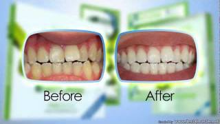 Natural teeth whitening system by Meodentalnow in Australia and NZ [upl. by Tybald768]