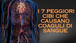 I 7 Peggiori Cibi che Causano Coaguli di Sangue [upl. by Rosella68]