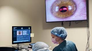 Live PRK Procedure at Commonwealth Eye Surgery [upl. by Havard]