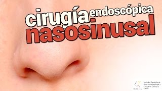 Cirugía endoscópica nasosinusal CENS  SEORL CCC [upl. by Engvall58]