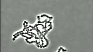 Bacteria Streptococcus pyogenes [upl. by Yanel]