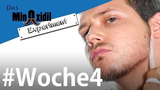 Minoxidil  Routine für den Bart  Das Minoxidil Experiment Woche4 [upl. by Asillim380]