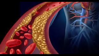 Foods To Lower Your Bad Cholesterol LDL [upl. by Ahsatam]