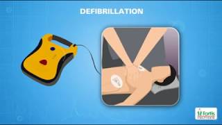 CPR Training  Cardiopulmonary resuscitation CPR [upl. by Ysus479]