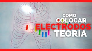 ✅COMO COLOCAR LOS ELECTRODOS DEL ELECTROCARDIOGRAMA ECG [upl. by Gerius]