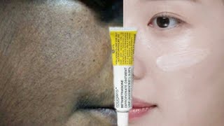 skin cream  betamethasone dipropionate cream  skin care  beauty tips  Brijwasi Girl [upl. by Kletter245]