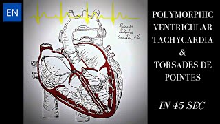 Polymorphic Ventricular Tachycardia Animation and ECG Shorts [upl. by Aelak]