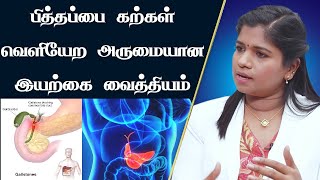 பித்தப்பை கற்கள் இருப்பதற்கான அறிகுறிகள் மற்றும் தீர்வு  Gallbladder Stone Removal Natural Way [upl. by Anele926]