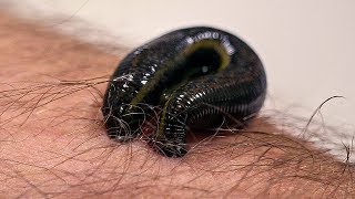 How Leeches are used in Modern Surgery  Earth Science [upl. by Editha528]