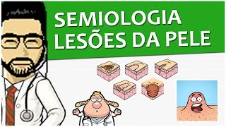 Semiologia 10  Lesões elementares da pele Vídeo Aula [upl. by Ayatnwahs]