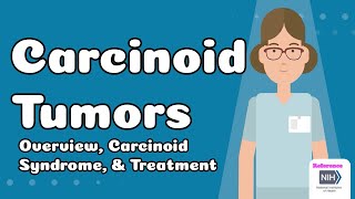 Carcinoid Tumors  Overview Carcinoid Syndrome amp Treatment [upl. by Cahn]