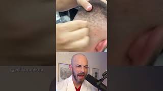 Dermatologist reacts to AWFUL scalp routine dermreacts doctorreacts [upl. by Eciral]