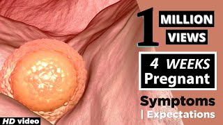 4 Weeks Pregnant Baby Position  Pregnancy Symptoms Week by Week [upl. by Shutz]