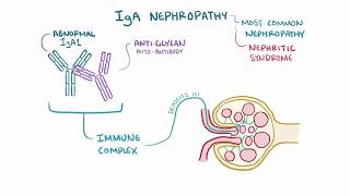 IgA nephropathy Berger disease causes symptoms diagnosis treatment pathology [upl. by Daffi]