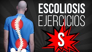 ESCOLIOSIS en S 👉 EJERCICIOS correctivos [upl. by Amehsat]