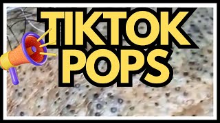 TikTok PIMPLES Popped [upl. by Ydur]