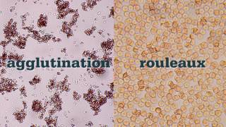 How to Perform a Saline Agglutination Test [upl. by Dazhahs837]