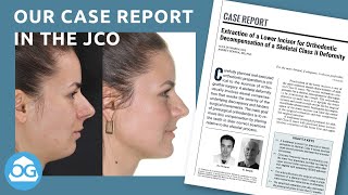 Our case report in the Journal of Clinical Orthodontics [upl. by Elockin]