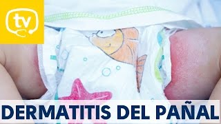 Soluciones para tratar la dermatitis del pañal [upl. by Clement]