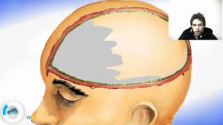 Brain Meninges  Dura Mater [upl. by Satterlee]