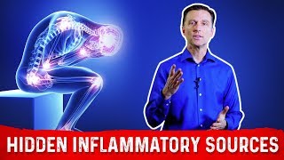 3 Surprising Hidden Causes Of Inflammation Revealed by Dr Berg [upl. by Raddie]