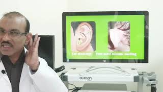 Acute mastoiditis Part 1 Hindi Patient teaching programme [upl. by Adele]