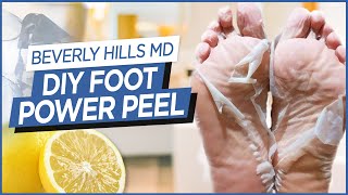 How To Make DIY Foot quotPower Peelquot Easy to make  Beverly Hills MD Beauty Tips [upl. by Lebiram]