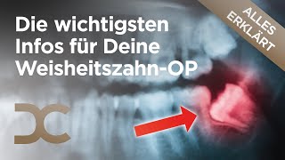 Weisheitszähne entfernen Alles zur schonenden WeisheitszahnOP in Dämmerschlaf  Dorow Clinic [upl. by Ybrek]