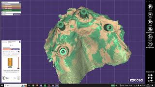 Exocad İmplant Kütühanesi Ekleme  How To Add Implant Library on Exocad [upl. by Case]