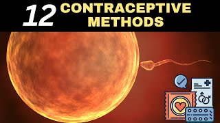 Secrets of Birth Control 12 Methods You Need to Try [upl. by Demmy248]