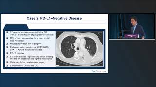 The “Immunosurge” Continues Expanding the Role of Immunotherapy in NSCLC [upl. by Noevart97]