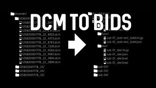 DICOM to BIDS conversion [upl. by Horodko]