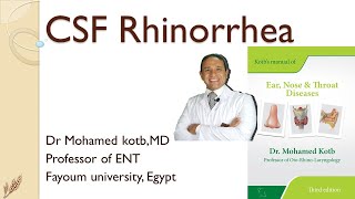 CSF rhinorrhea Professor Dr Qotb [upl. by Nasho]