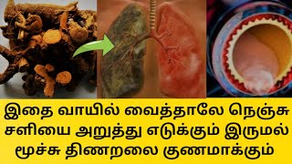 Perukala Marundhu  Uraippu Urundai  Medicine for Young Mothers post Delivery  Periya Amma Samayal [upl. by West107]