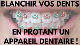 Comment Blanchir Vos Dents en Portant Un Appareil Dentaire [upl. by Delphine298]