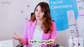 عنجد إذا أكلت شكولاته راح يزيد حب الشباب😒 ؟؟ skincare acne acnetreatment [upl. by Lanza]