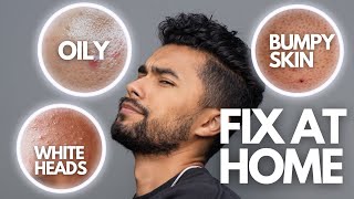 6 Skin Problems You Can Fix At Home FAST [upl. by Brenza]