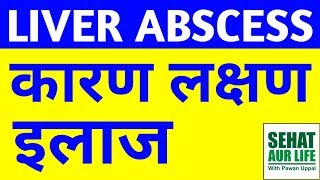 Liver Abscess कारण लक्षण इलाज Causes Symptoms Diagnosis Treatment In Hindi [upl. by Irihs]