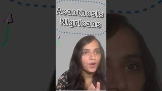 Do you have dark neck acanthosisnigricans insulinresistance [upl. by Shirah]