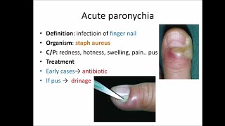 Hand infections [upl. by Arbe]