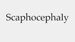 How to Pronounce Scaphocephaly [upl. by Viviyan]