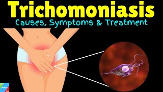 Trichomoniasis Causes Symptoms Diagnosis Treatments and prevention [upl. by Tegan262]