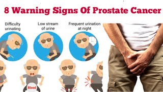 8 Signs That You Have Prostate Cancer Symptoms Prostate Cancer in Males [upl. by Duile242]