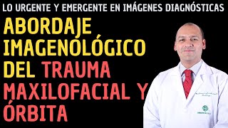 Abordaje imagenológico del trauma maxilofacial y órbita [upl. by Thomasine]