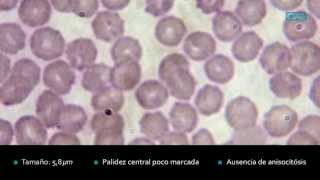 ‪Hematología Serie roja equina normal CIAB wwwciabes‬ [upl. by Enialehs326]