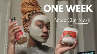 Trying The Famous Aztec Clay Mask For 1 Week Check Results [upl. by Kenway]